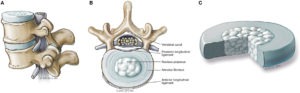 Intervertebral disc components 
